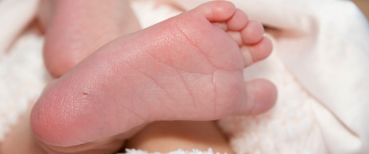 Descubren nueva variante estructural del gen asociada a fenilcetonuria (PKU) en Chile